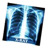xray